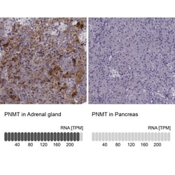 PNMT Antibody, Novus Biologicals 0.1mL; Unlabeled:Antibodies, Polyclonal